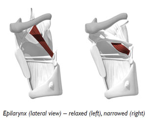 Epilarynx narrowing